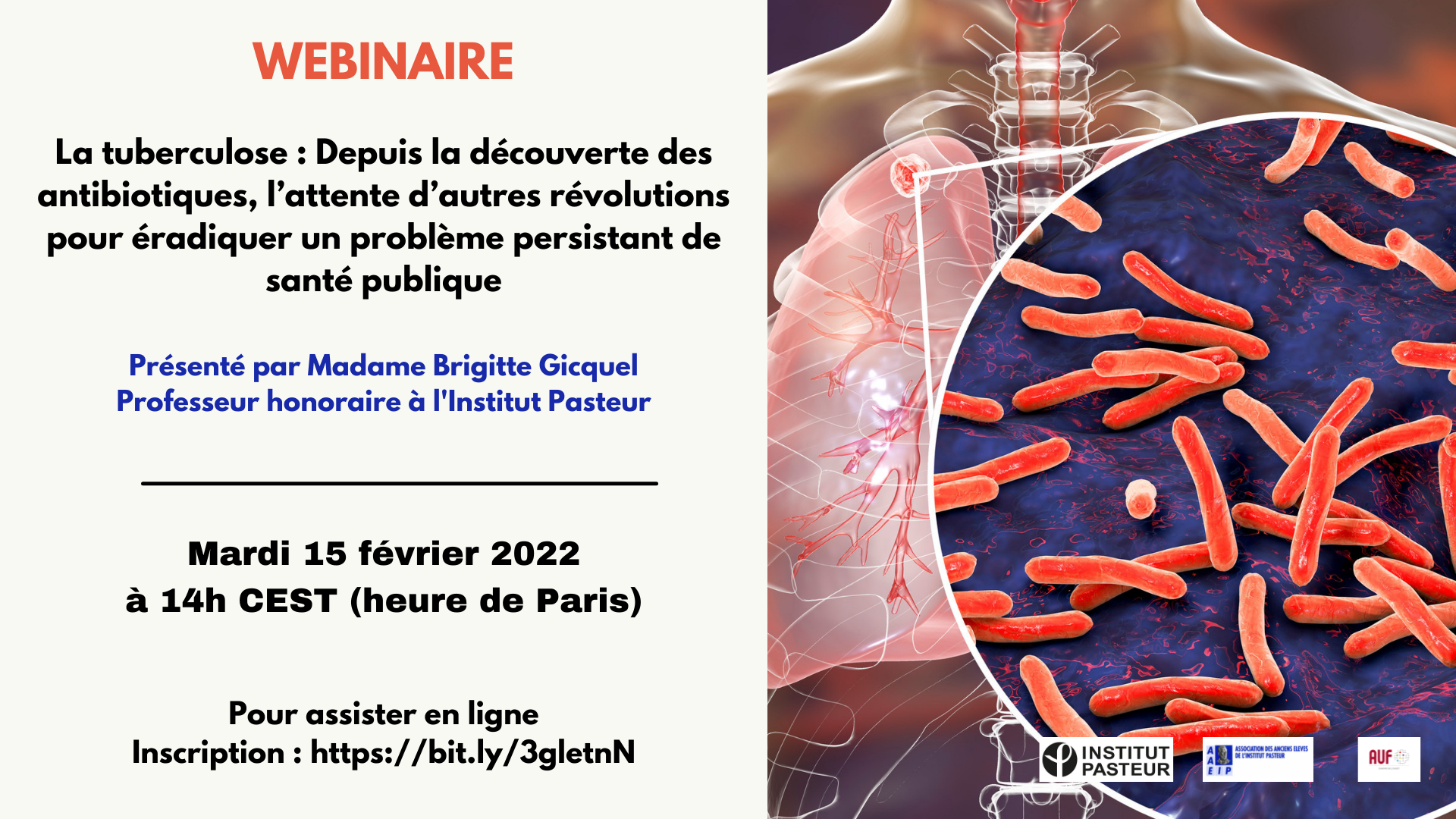 WEBINAIRE IP 15 fevrier 2022